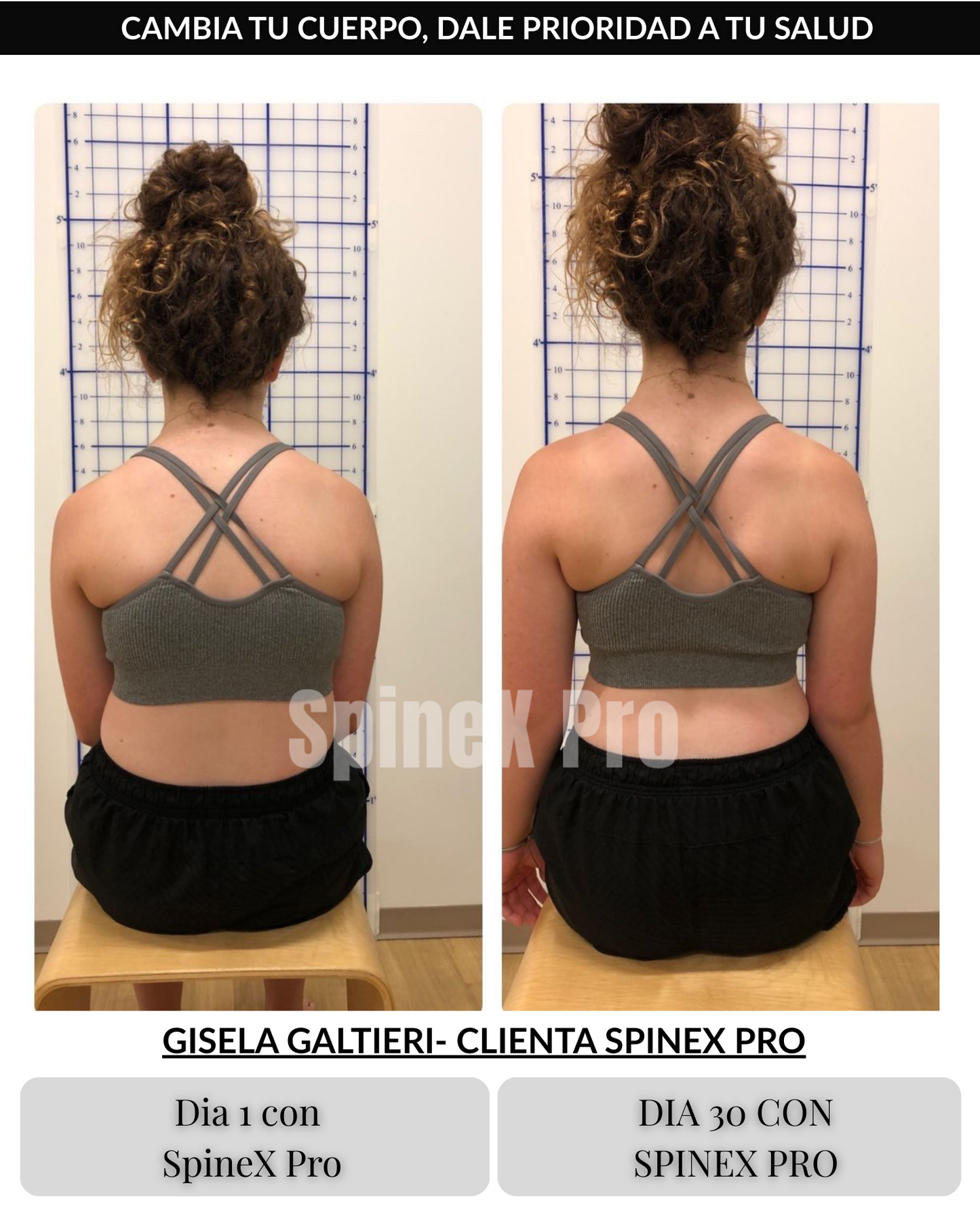 SpineX Pro – Corrector de Postura + Rutina de Ejercicios
